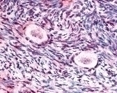 GSK3B (phospho Ser9) Antibody