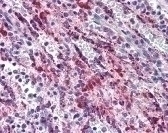 TGFB1 Antibody