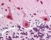 FANCA Antibody
