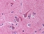 Slit Homolog 1 Antibody