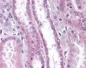 Apolipoprotein D Antibody