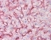 SLC2A2 Antibody, Monoclonal