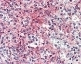 CCL5 Antibody, Monoclonal