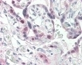 CDK2 Antibody, Monoclonal