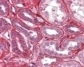 Collagen IV Antibody
