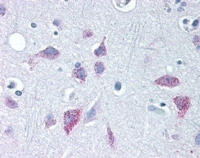 WNT8B Antibody