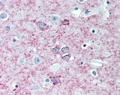 Adenosine A2a Receptor Antibody [7F6-G5-A2 / 7F6]