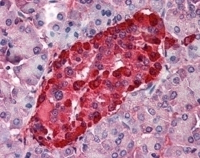 Transthyretin Antibody