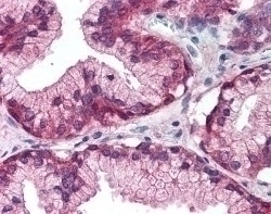 EGF Receptor Antibody