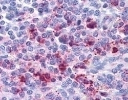 IL-8 Receptor B Antibody