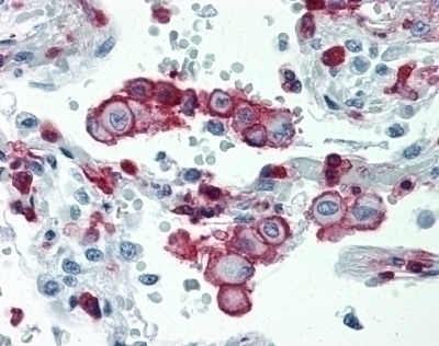 CD18 Antibody [MEM-48]
