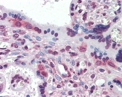 PEA3 Antibody [1A2G3]