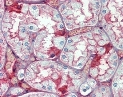 Albumin Antibody [2H3D1;8F6F9]