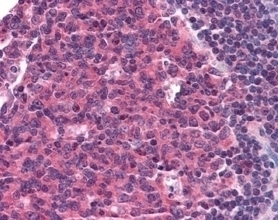 CCR5 Antibody [T21/8]