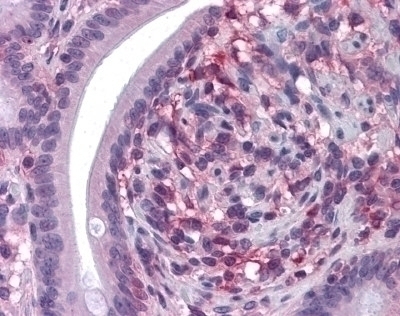 CD69 Antibody [8B6]