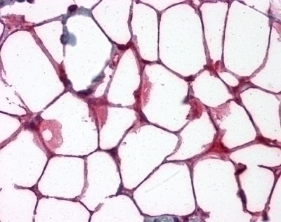 VCAM1 Antibody [6G9]