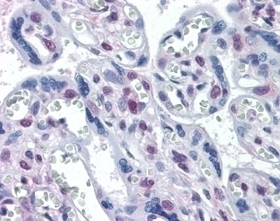 DRAK1 Antibody [4D12]