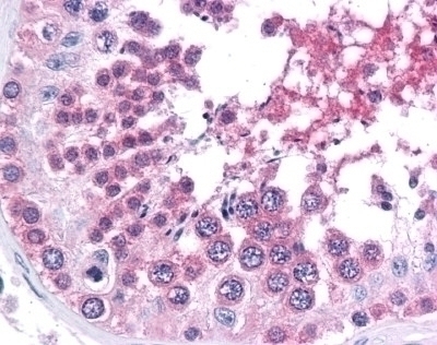 BRG1 Antibody [BRG-01]