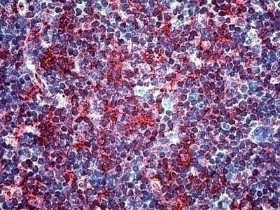 Transforming Growth Factor Beta Antibody [TB21]