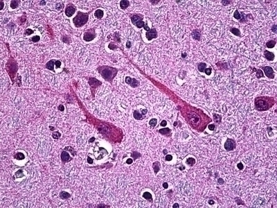 PCSK1 Antibody [3D2]