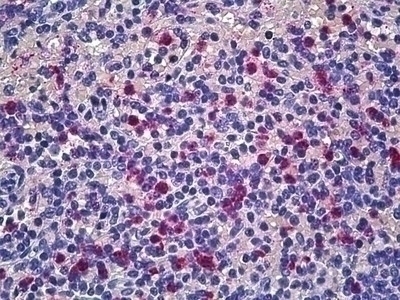 CD177 Antibody [4C4]
