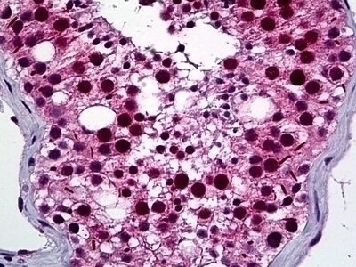 NEK2 Antibody [2F6]