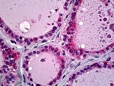 SP-D Antibody [2A10]