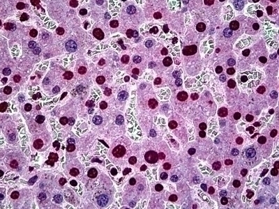 SGK1 Antibody [3G8]