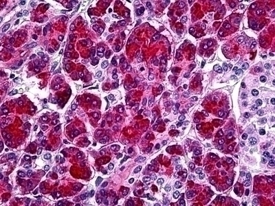 SPINK1 Antibody [4D4]