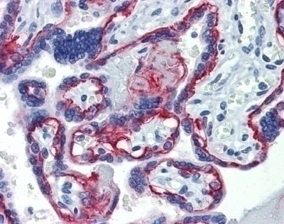 ITGB4 Antibody [439-9B]