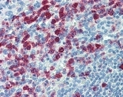 SELPLG Antibody [HECA-452]