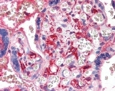 PF4 Antibody