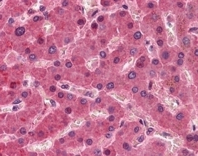 Factor 12 Antibody