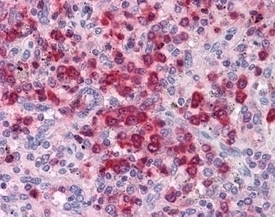 ELANE Antibody