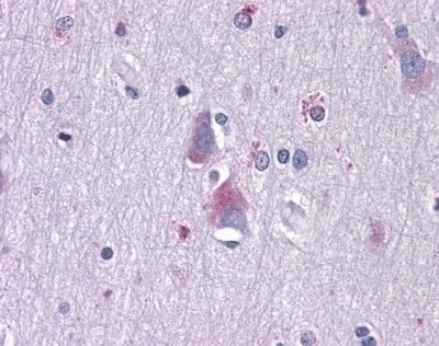 AXL Antibody [7E10]