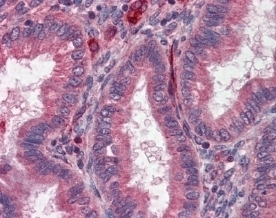 Acetylcholinesterase Antibody