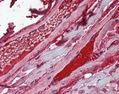 Factor 10 Antibody