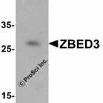 Western blot analysis of ZBED3 in human lung tissue lysate with ZBED3 antibody at 1 μg/mL in (A) the absence and (B) the presence of blocking peptide.