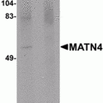 Western blot analysis of MATN4 in rat brain tissue lysate with MATN4 antibody at 1 μg/mL in (A) the absence and (B) the presence of blocking peptide.
