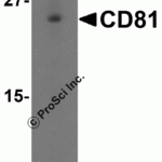 Western blot analysis of CD81 in human lung tissue lysate with CD81 antibody at 1 μg/mL in (A) the absence and (B) the presence of blocking petide.