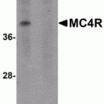 Western blot analysis of MC4R in rat brain tissue lysate with MC4R antibody at 1 μg/mL in (A) the absence and (B) the presence of blocking peptide.