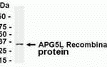 E coli-derived recombinant protein as test antigen. Affinity-purified IgY dilution: 1:2000, Goat anti-IgY-HRP dilution: 1:1000. Colorimetric method for signal development.
