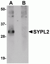SYPL2 Peptide