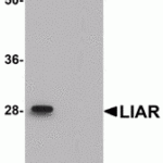 Western blot analysis of LIAR in mouse kidney tissue lysate with LIAR antibody at 1 μg/mL in (A) the absence and (B) the presence of blocking peptide.