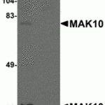 Western blot analysis of MAK10 in rat heart tissue lysate with MAK10 antibody at 1 μg/mL in the (A) absence and (B) presence of blocking peptide.