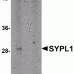 Western blot analysis of SYPL1 in human brain tissue lysate with SYPL1 antibody at 1 μg/mL in (A) the absence and (B) the presence of blocking peptide.