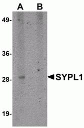 SYPL1 Peptide
