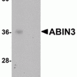 Western blot analysis of ABIN3 in human spleen tissue lysate with ABIN3 antibody at 1 μg/mL in (A) the absence and (B) the presence of blocking peptide.