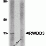 Western blot analysis of RWDD3 in rat kidney tissue lysate with RWDD3 antibody at 1 μg/mL in (A) the absence and (B) the presence of blocking peptide.