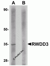 RWDD3 Peptide